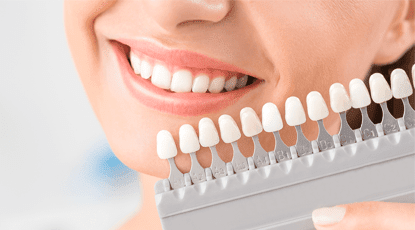 Veneers Offer Dentist in Canberra